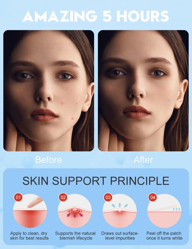 Detalle 1 de Hydrocolloid Pickelpatch WakeALL 250 Stück