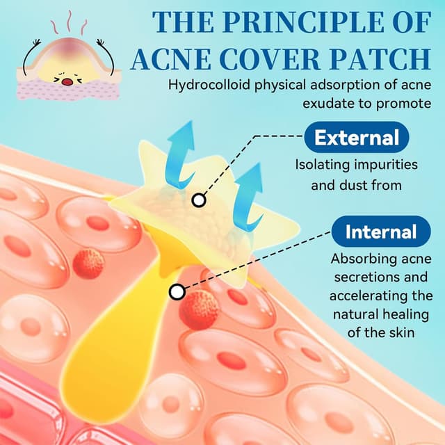 Detalle 2 de 397 Stück Bunte Sterne Pickelpflaster 🩹