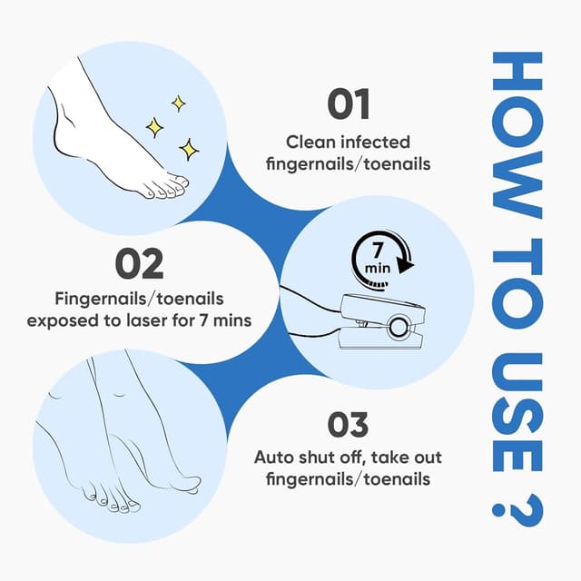 Thumbnail 4 de Berrlly Láser 460nm para Hongos en Uñas 🦶 Fácil y Efectivo