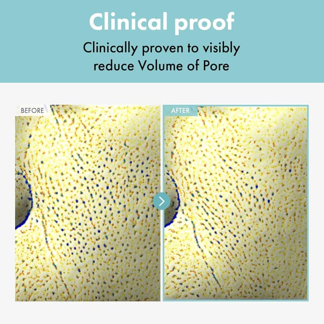 Detalle de TOSOWOONG crema raffinatrice di pori per il viso, riduce e minimizza l’aspetto dei pori (50 g)