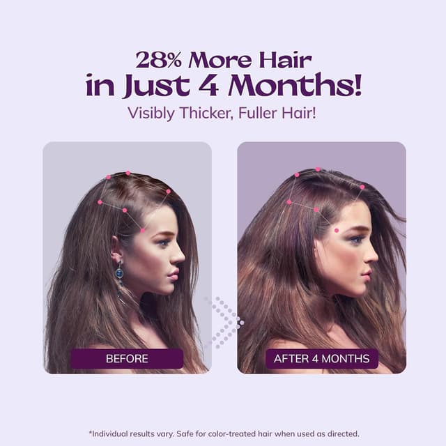 Detalle 2 de Minoxidil 5% spray for women 2 fl oz