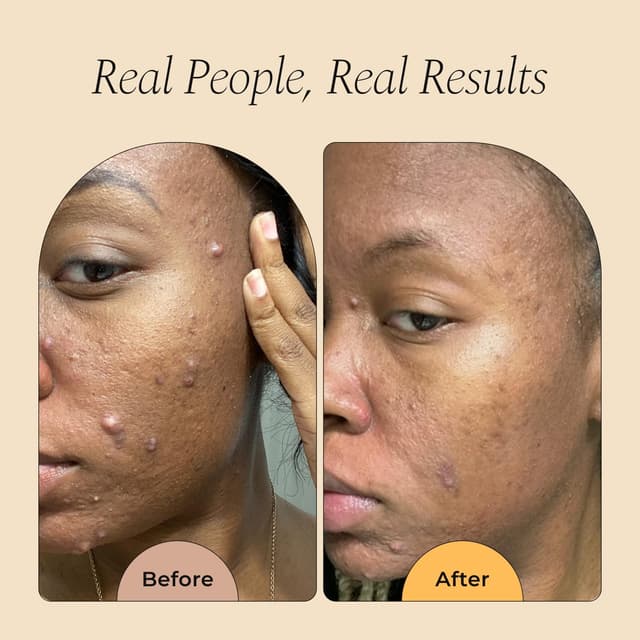 Detalle de Glo Melanin Turmeric & Kojic Foaming Face Wash with Scrubber Top (4 fl oz)