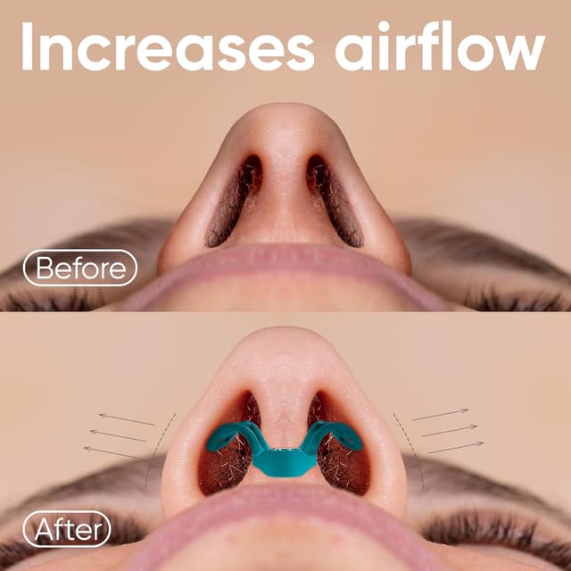 Thumbnail 2 de Brison Nasal Dilators 2-pack anti-snoring nose vents 😷