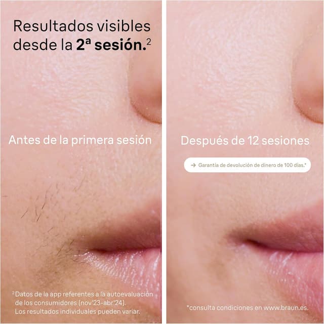 Thumbnail 2 de Braun Silk‑expert Pro 5 PL5157 depiladora IPL 5 niveles