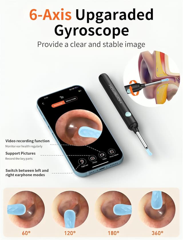 Thumbnail 5 de Hopefox Otoskop 1080P WiFi Ohrreiniger