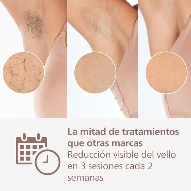 Detalle de Philips Lumea Serie 9900 depiladora IPL 4 cabezales