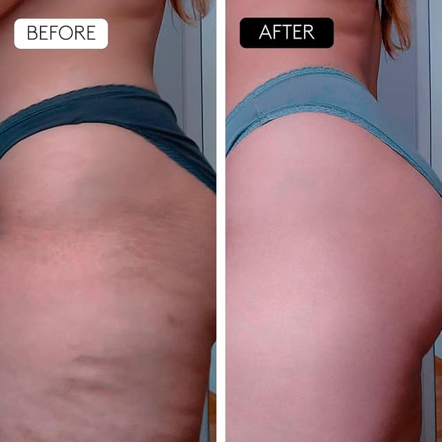 Thumbnail 5 de COCUNAT Body Power Anticelulítico 150 ml + 125 ml