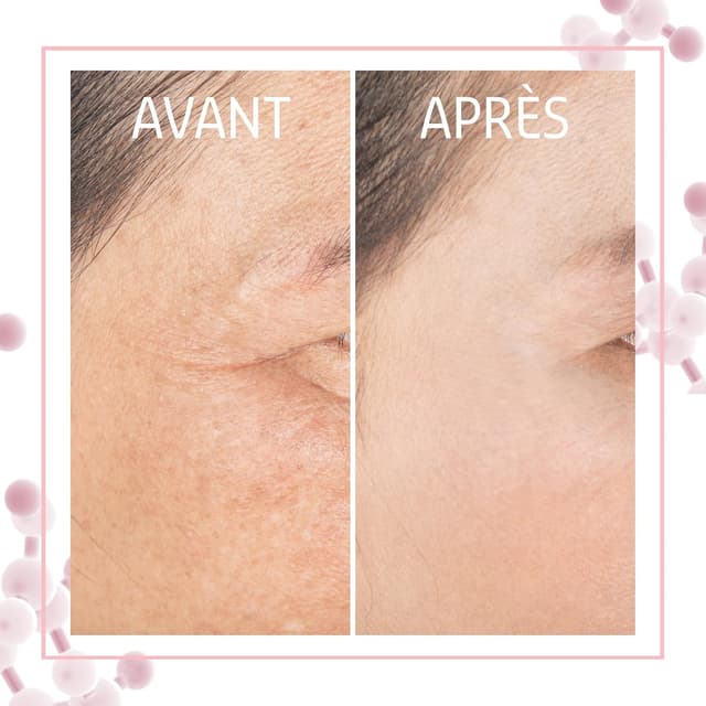 Detalle de Coffret sérum au rétinol Visage Femme Elemental Care (1 sérum + 5 ampoules) – soin anti-âge et sébum