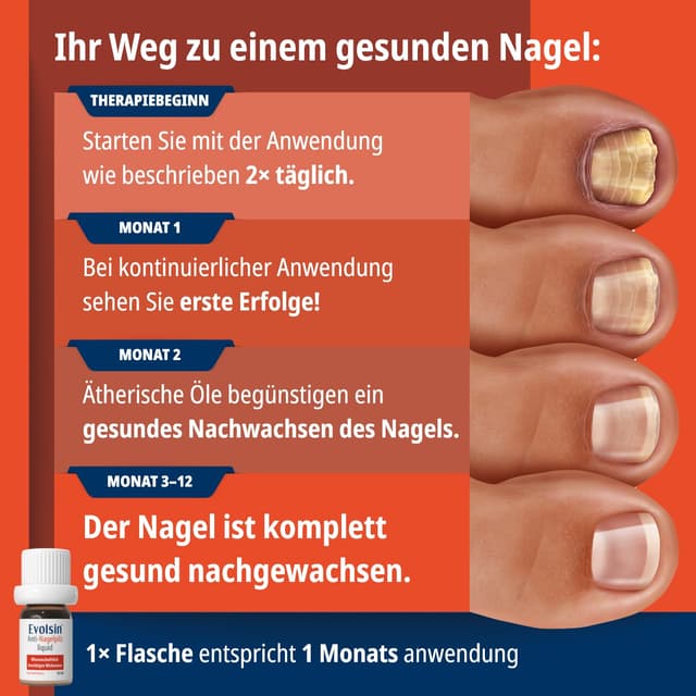 Thumbnail 6 de Evolsin® Anti-Nagelpilz Liquid – Medizinprodukt gegen Nagelpilz an Händen & Füßen, auch für Diabetiker