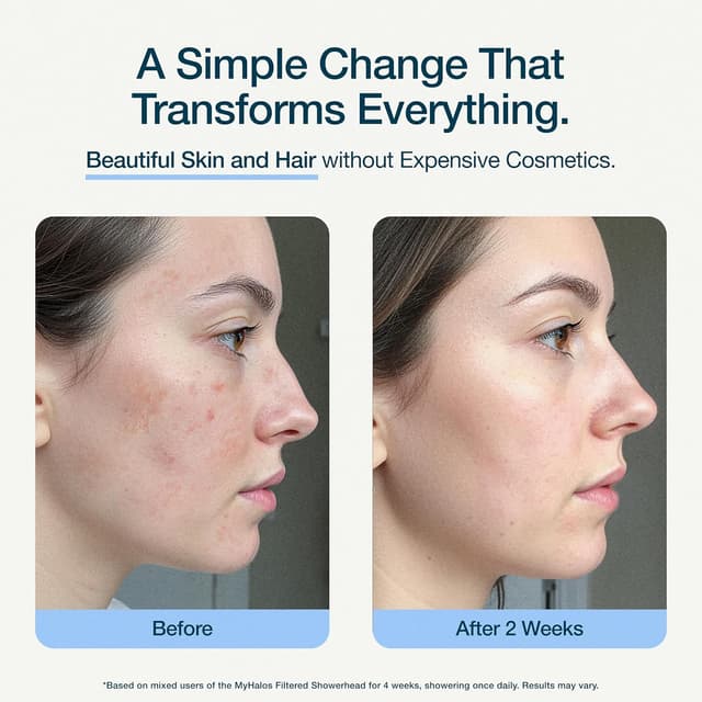 Thumbnail 6 de MyHalos Shower Filter for Hard Water UK (High Pressure Fixed Filter Shower Head) – Chrome