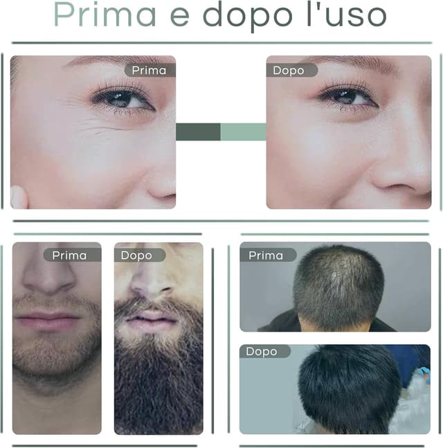 Thumbnail 4 de Dr.roller Dermastamp 0-3mm, 140 micro-aiguilles ⚙