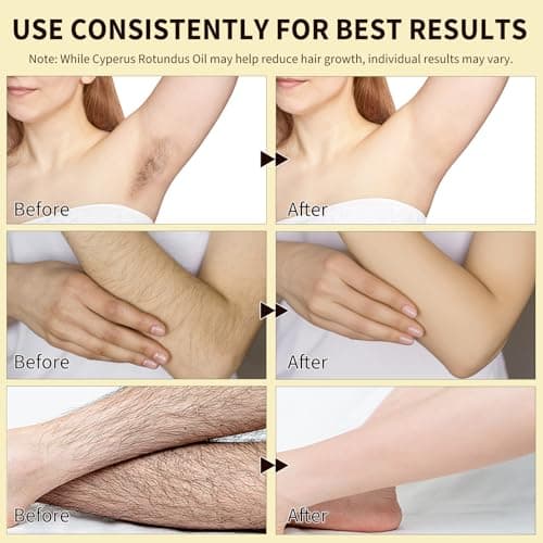 Thumbnail 7 de Tiuedu Cyperus Rotundus Aceite para depilación y reducción del vello (60)