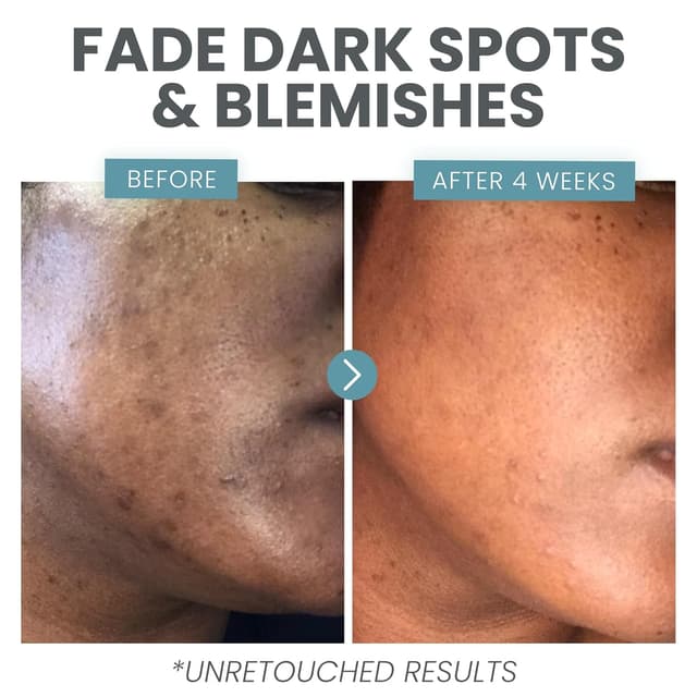 Thumbnail 4 de Vitamin C Serum for Face with Retinol 30 ml