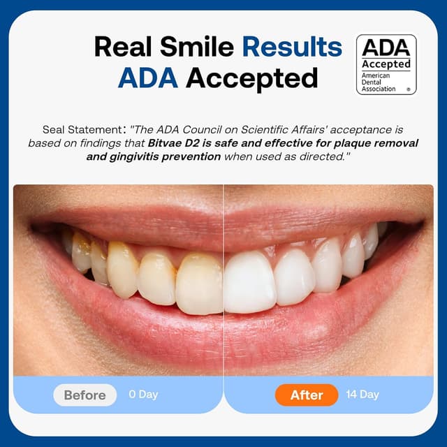 Thumbnail 2 de Bitvae Ultrasonic Toothbrush 60-Day Battery