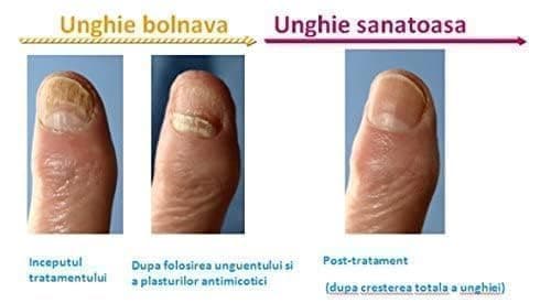 Thumbnail 3 de Vichy Déodorant Aérosol 48 H ⚙