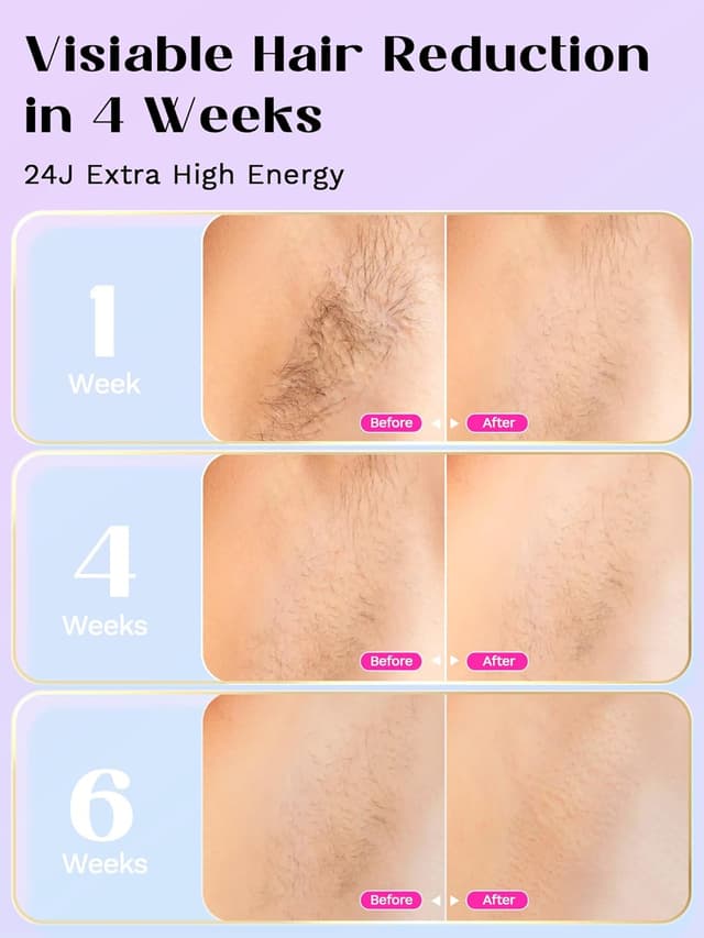 Thumbnail 5 de Wavytalk Depiladora Láser con Enfriamiento y Alta Energía