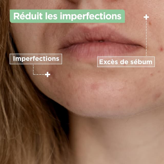 Detalle de Mixa Anti-Unreinheiten Duo aus Niacinamid-Serum und Cleanser – für zu Unreinheiten neigende Haut