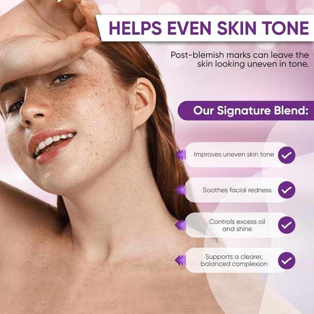 Detalle de AOBBIY Azelaic Acid Cream for Face (1 oz) for redness, uneven tone, and blemish-prone skin