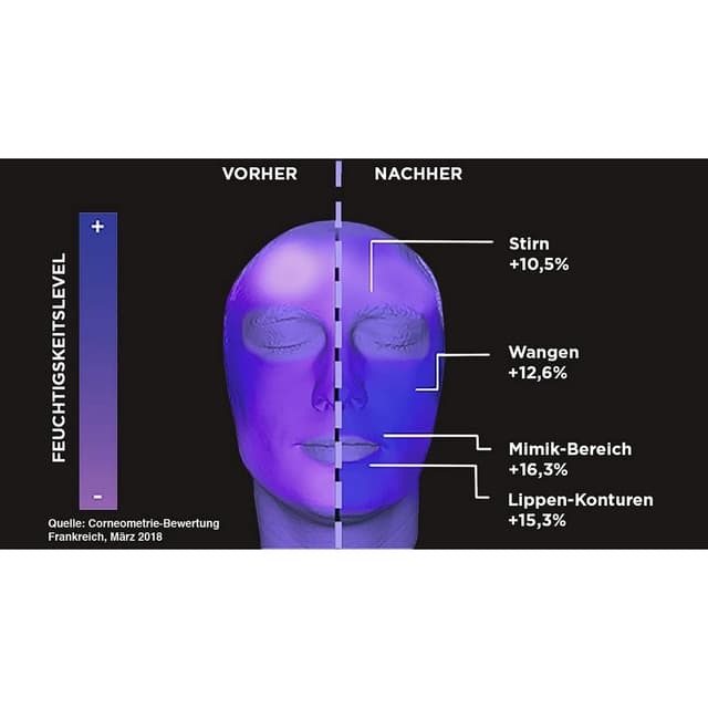Detalle de L'Oréal Paris Revitalift Filler Hyaluron-Shots für Frauen – 7-Tage-Kur mit reiner Hyaluronsäure & Vitamin B5 (7 Einzeldosis-Ampullen)