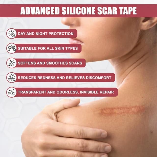 Thumbnail 6 de ICONRY Silicone scar tape roll 1.6 in