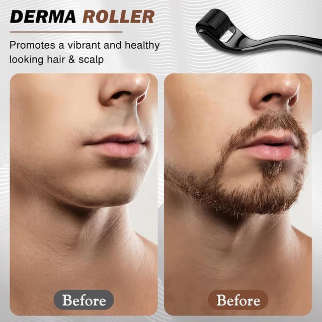 Thumbnail 4 de Bartroller 0,5 mm Derma-roller mit 540 Titan-Nadeln für Bartwuchs