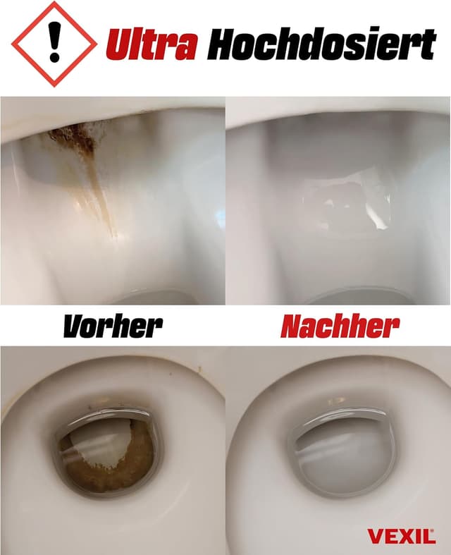 Thumbnail 3 de VEXIL Urinsteinentferner EXTRA STARK 1000 ml