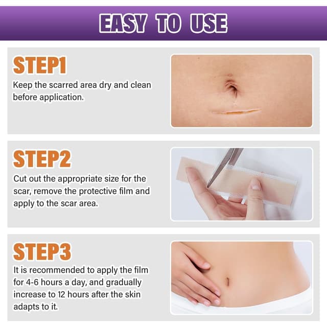 Thumbnail 6 de Silicone Scar Sheets 1.6" x 157" Roll