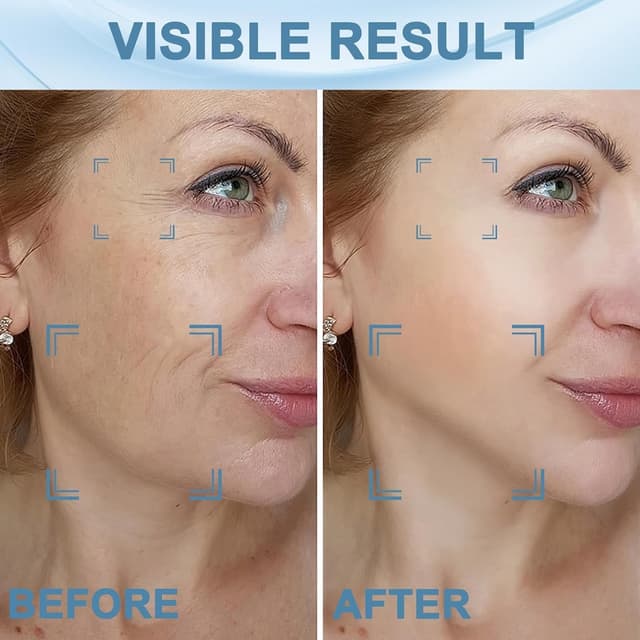 Detalle 1 de INTENSO Face Massager for Anti-Aging and Facial Care