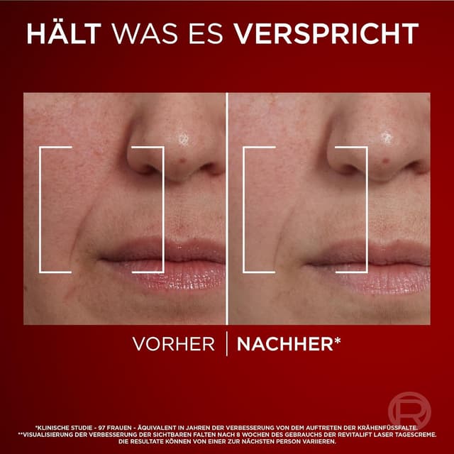 Thumbnail 4 de L'Oréal Paris Revitalift Laser Gesichtspflegeset 2×50 ml