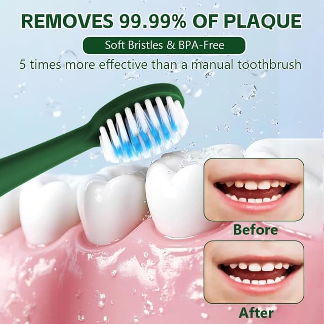 Thumbnail 6 de Vicloon Spazzolino Elettrico per Bambini con timer intelligente e 6 testine sostituibili (IPX6)