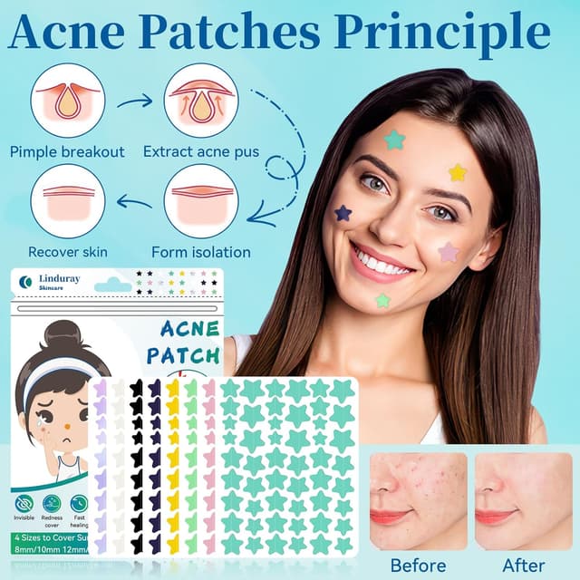 Detalle de 397 Stück Bunte Sterne Pickelpflaster 🩹