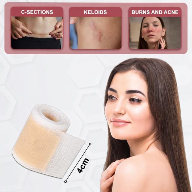 Detalle 2 de ICONRY Silicone scar tape roll 1.6 in