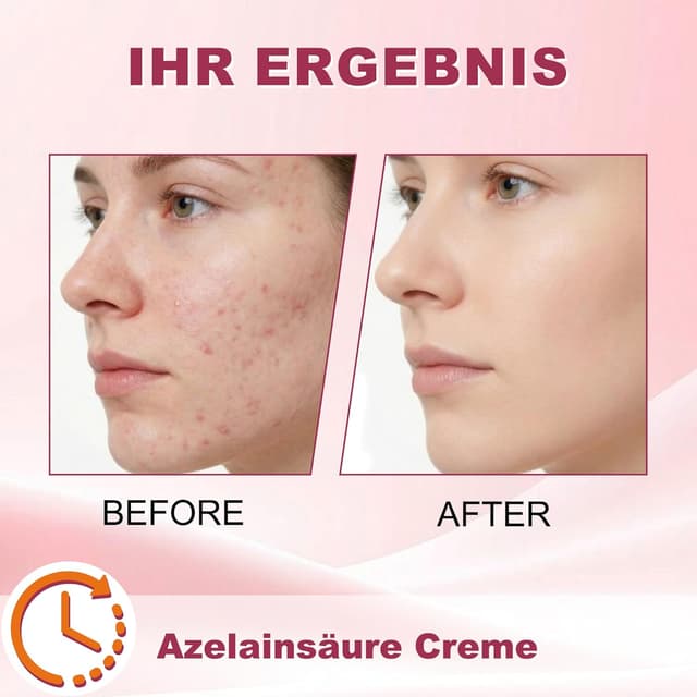 Detalle 2 de Azelainsäure Creme 20 g mit 15 % Azelainsäure – für weniger Hautunreinheiten und ein gepflegtes Hautgefühl