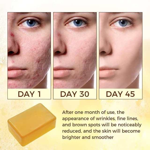 Detalle de OUKEYA Kurkuma Seife 2 Stück Hautklar