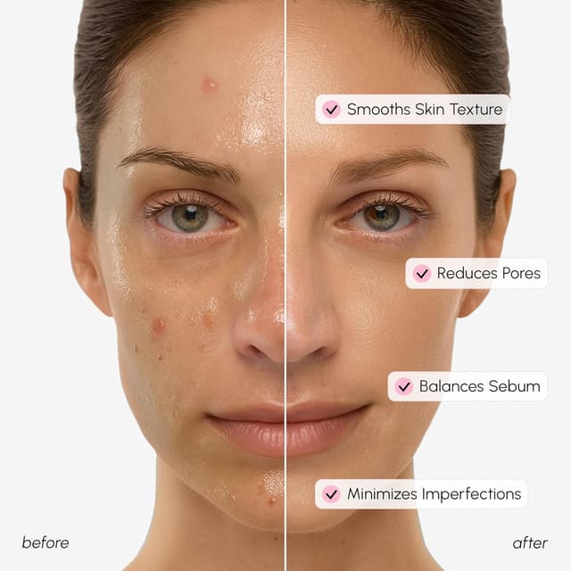 Thumbnail 3 de MAREE Pore Minimizer Facial Toner with Niacinamide 150ml