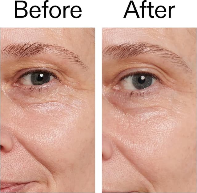 Thumbnail 4 de The INKEY List Retinol Eye Cream 15 ml