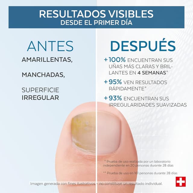 Detalle 1 de PODERM Uñas Amarillas y Dañadas