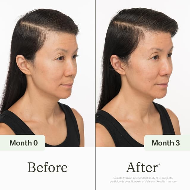 Detalle 2 de Divi Scalp Serum for Thinning Hair