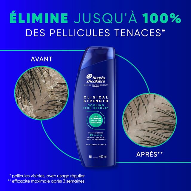 Thumbnail 2 de Head & Shoulders Apaisement des Démangeaisons 400ml