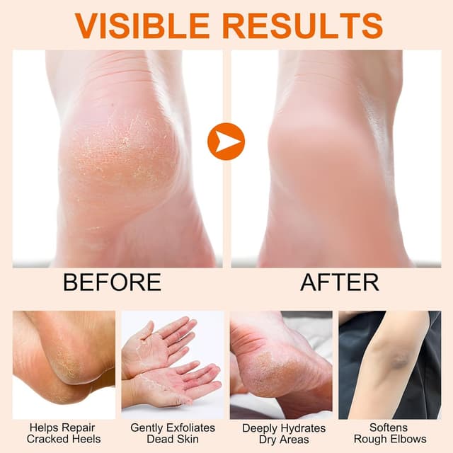 Detalle 1 de Manuka Miel Crème pour Talons et Coudes 40 g