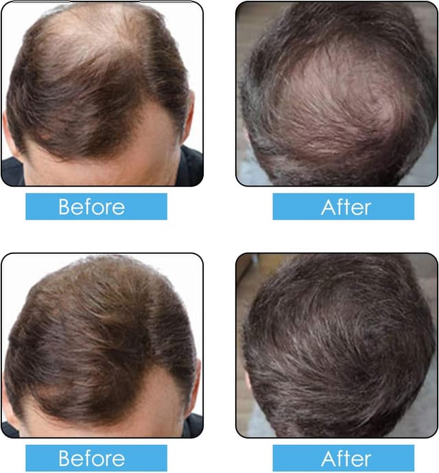 Detalle 2 de IKZEE Fibre per capelli nere (Nero) 50 g: fibre per correggere diradamento e zone calve