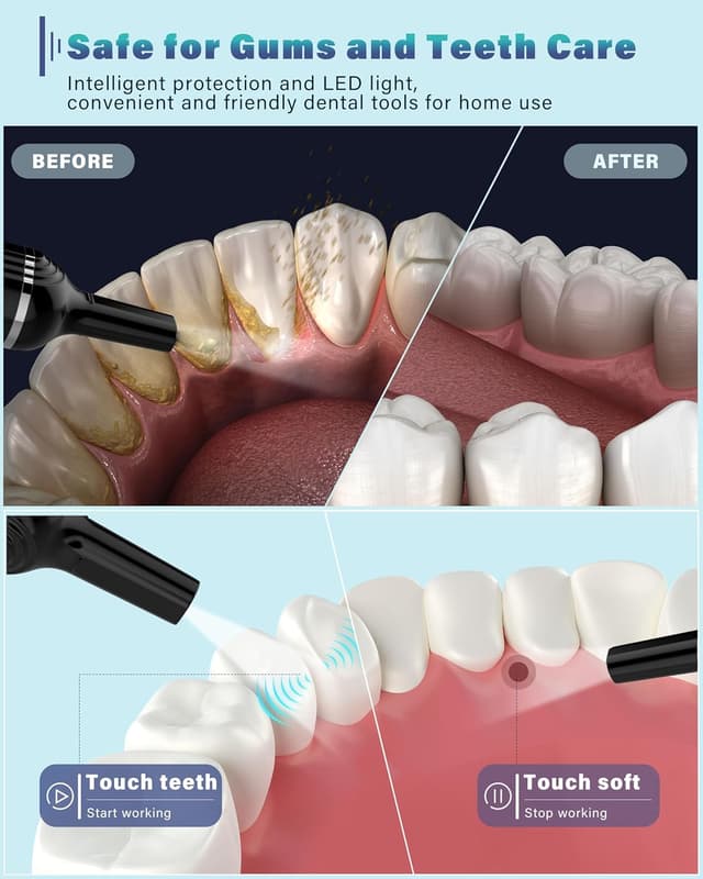 Detalle de Stim-U-Dent Zahnsteinentferner für Zuhause