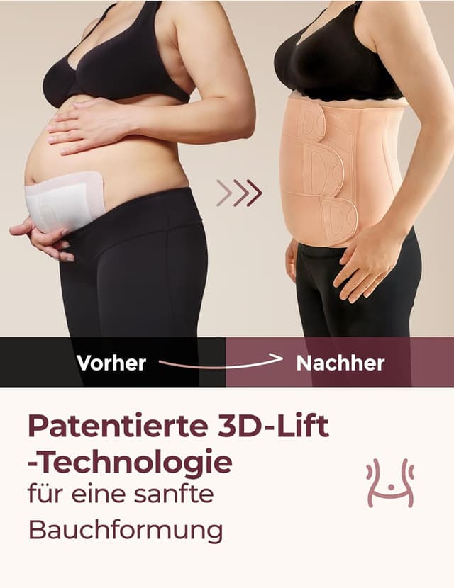 Detalle de Momcozy Ergowrap Bauchgurt nach Geburt (Kaiserschnitt-Rückbildung) – 3D-Kompression & Rückenstütze, nahtlos, Standard M