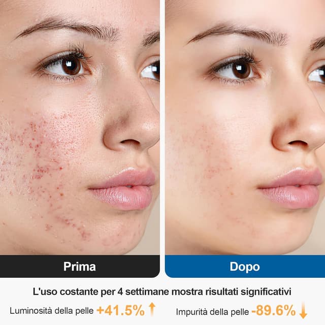 Thumbnail 4 de Rkdely Spazzola Pulizia Viso 500 mAh