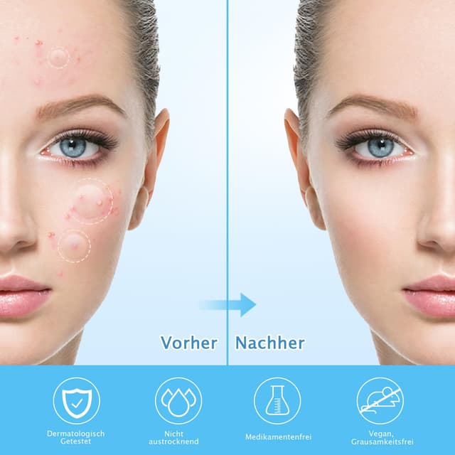 Detalle 2 de 360 Stück Pickel Patch Hydrokolloid 🩹