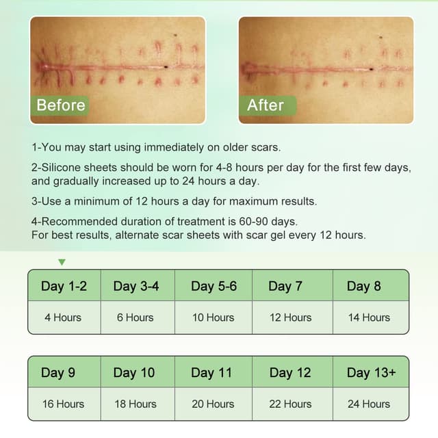 Thumbnail 5 de Silicone Scar Sheets 1.6" x 120" Roll