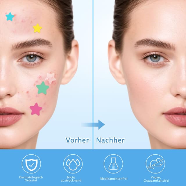Detalle 2 de Hydrokolloid Pickel Pflaster mit Teebaumöl & Salicylsäure (360 Stück, 3 Größen) für Gesicht und Körper