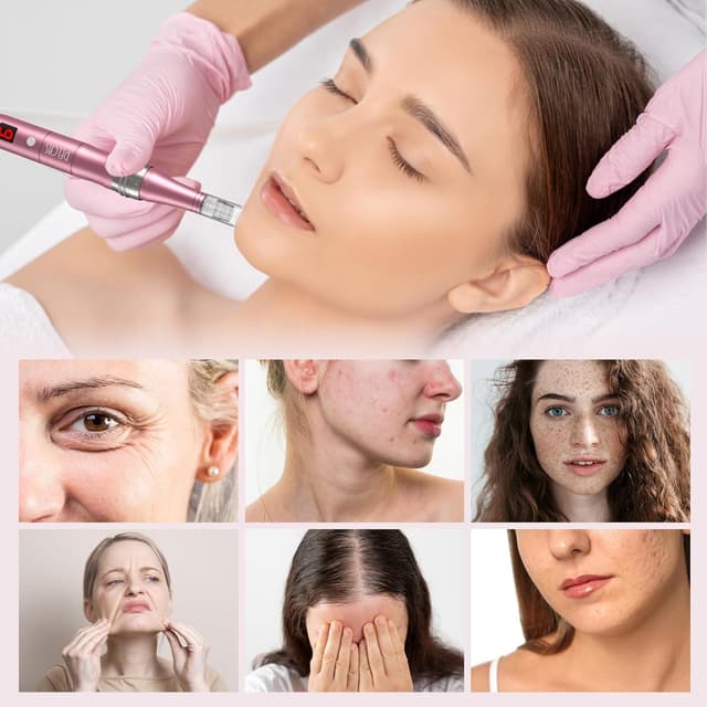 Detalle de Derma Pen PELCAS Elektrischer Microneedling Pen 9 Stufen