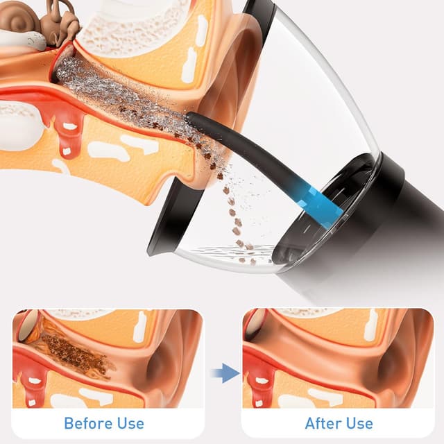 Detalle de ZonGym Electric Ear Wax Removal Kit with Retractable Ear Syringe and 4 Pressure Modes