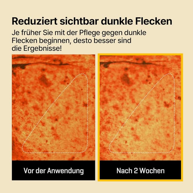 Detalle de SOME BY MI Yuja Niacin Anti Blemish Daily Mask – maschera viso giornaliera con niacinamide (30 fogli)